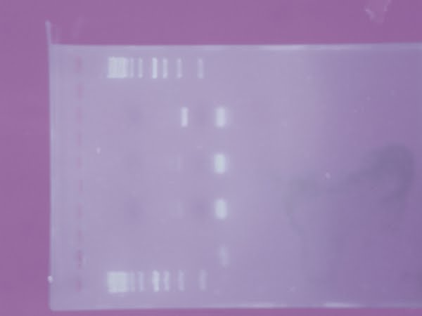 Agarose Gel Electrophoresis  Actual Size Image