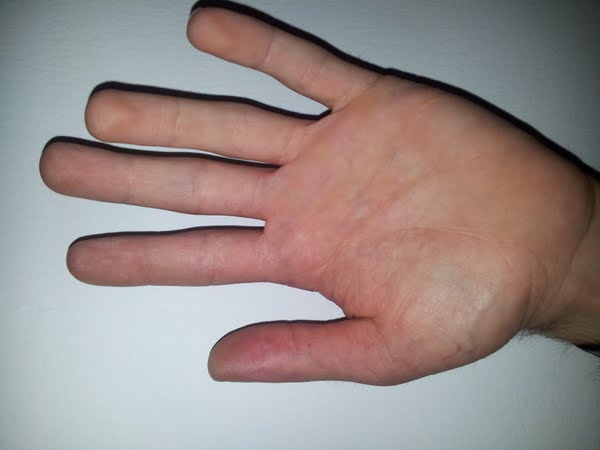 Hand of a 28 years old man whose height is 152 cm. compare and comment as you want. Actual Size Image