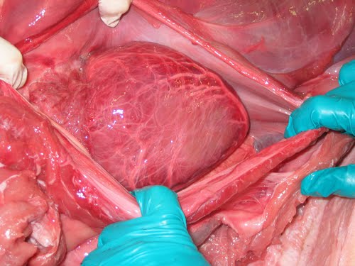 Human Heart Actual Size Image